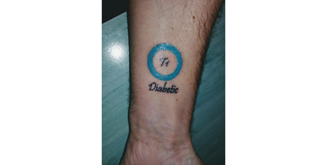 diabtatoo