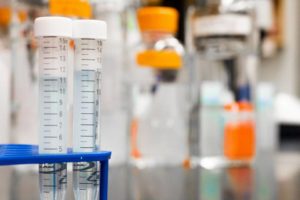 teste_eprubete_laborator_analize_24424600